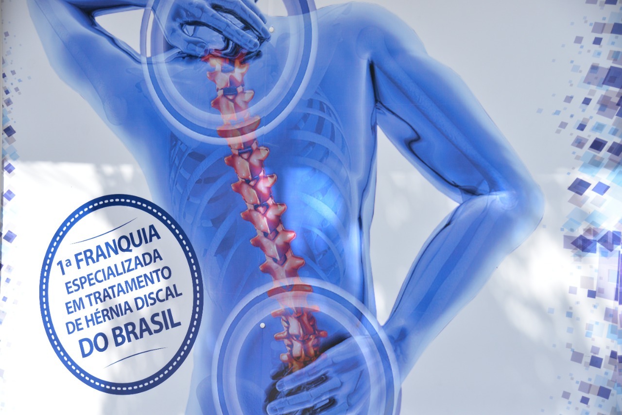 Franquia Doutor Hérnia, conhecida por oferecer tratamento sem cirurgia contra hérnia de disco, chegou em Araucária