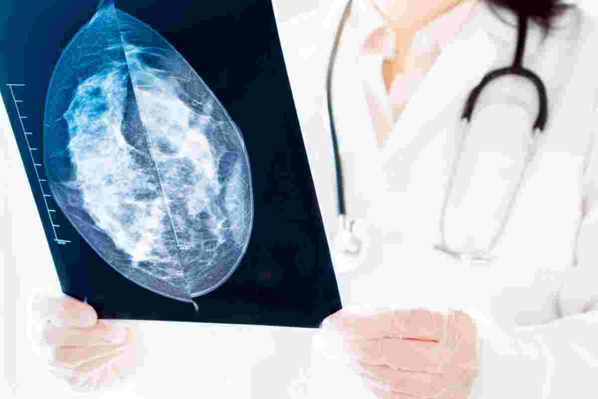 UBS’s farão mutirão para realizar preventivo e agendamento de mamografia