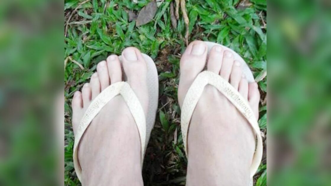 Em tempos de Copa do Mundo, arauca­riense com 6 dedos em cada pé garante que é “pé quente” e torce pelo hexa