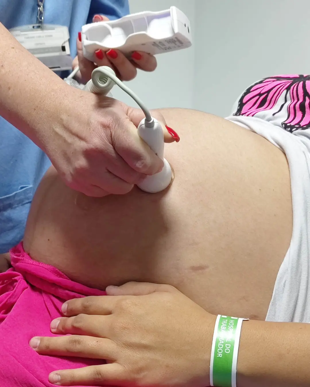 Nos últimos 5 anos, gravidez na adolescência apresentou redução de 23% em Araucária