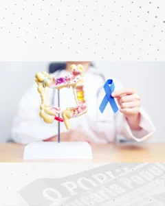 Médico alerta para a importância do diagnóstico precoce do câncer colorretal