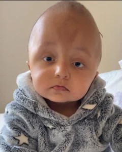 Família cria vakinha para pagar cirurgias de bebê de 1 ano