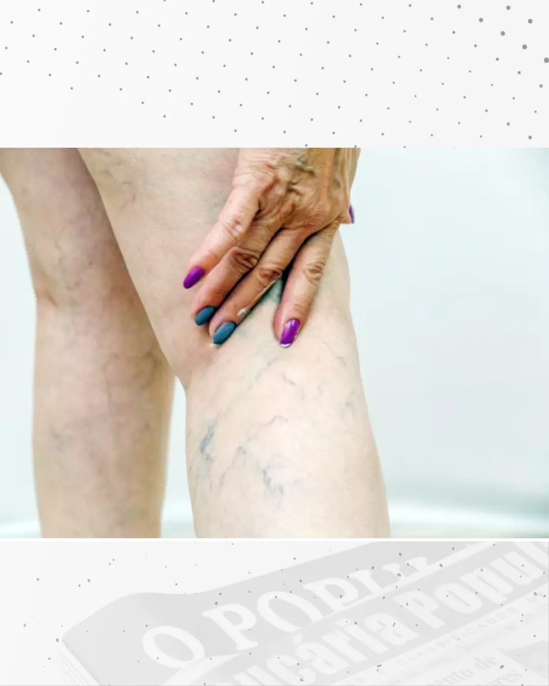 Dia Nacional de Combate e Prevenção à Trombose: especialista fala dos riscos da doença
