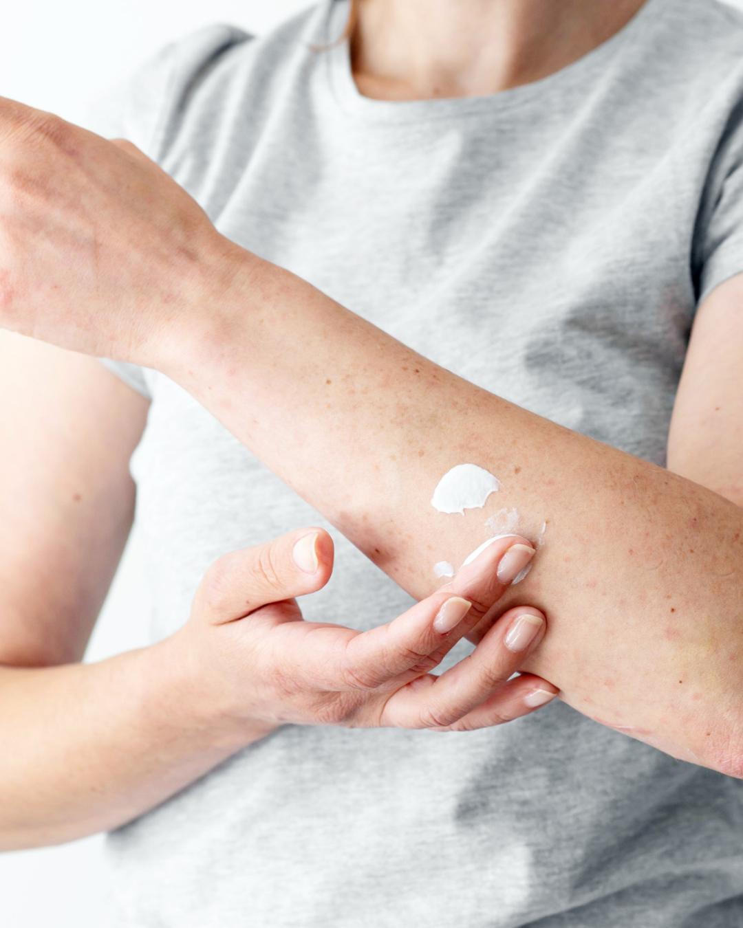 Médico orienta sobre como cuidar da pele com a chegada da primavera