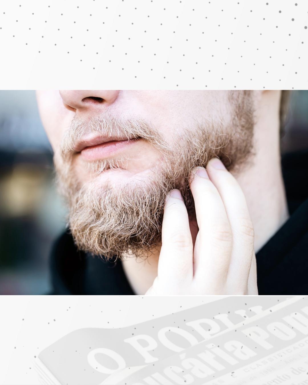 Especialista alerta para casos de infecção na barba que pode ser confundida com acne