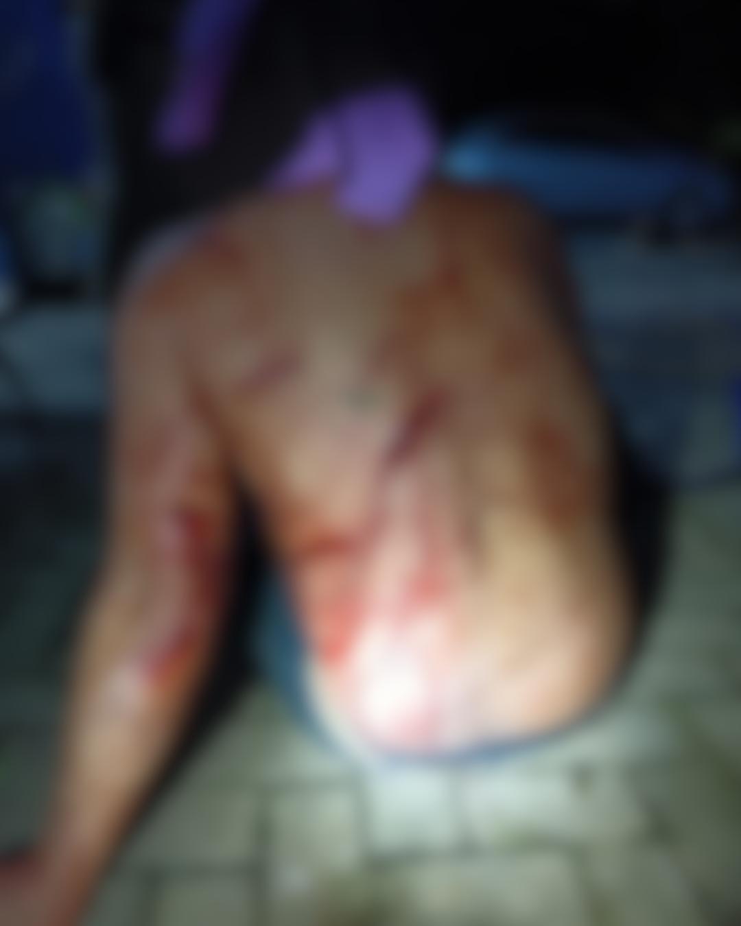 Homem marca conversa com ex e é agredido por dois indivíduos