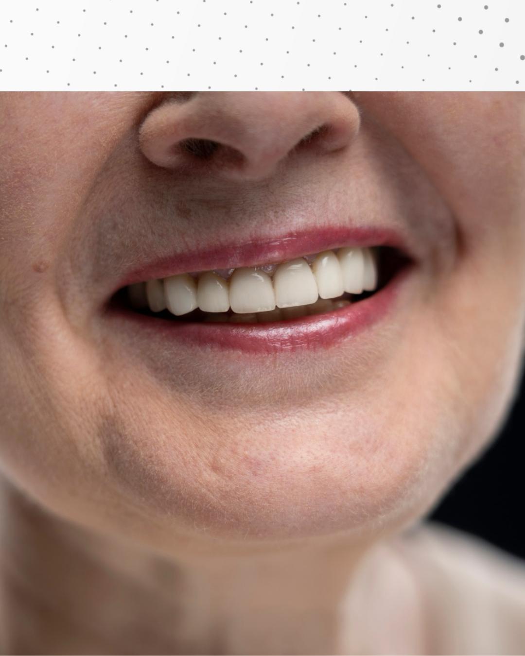 Moradores de Araucária poderão contar com serviço de prótese dentária gratuita pelo SUS