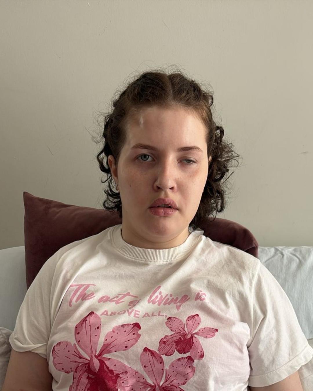 Família de jovem atropelada em frente à Unifacear realiza rifa para ajudar no tratamento da jovem