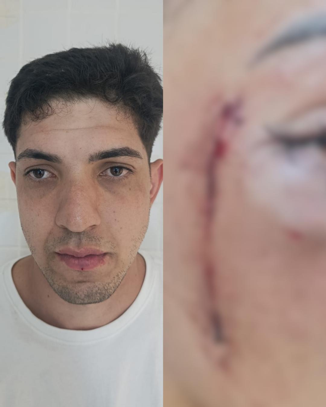 No Costeira, PM salva vida de mulher que era espancada pelo marido no meio da rua