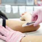 Implanon pelo SUS: Araucária vem ampliando a oferta do contraceptivo