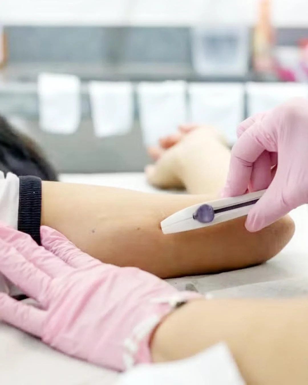 Implanon pelo SUS: Araucária vem ampliando a oferta do contraceptivo