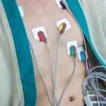 NP: Secretaria passa a oferecer exames de eletrocardiograma também em UBSs