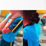 Clínica explica o que a picada de abelha pode causar no corpo e como uma pessoa pode identificar a alergia