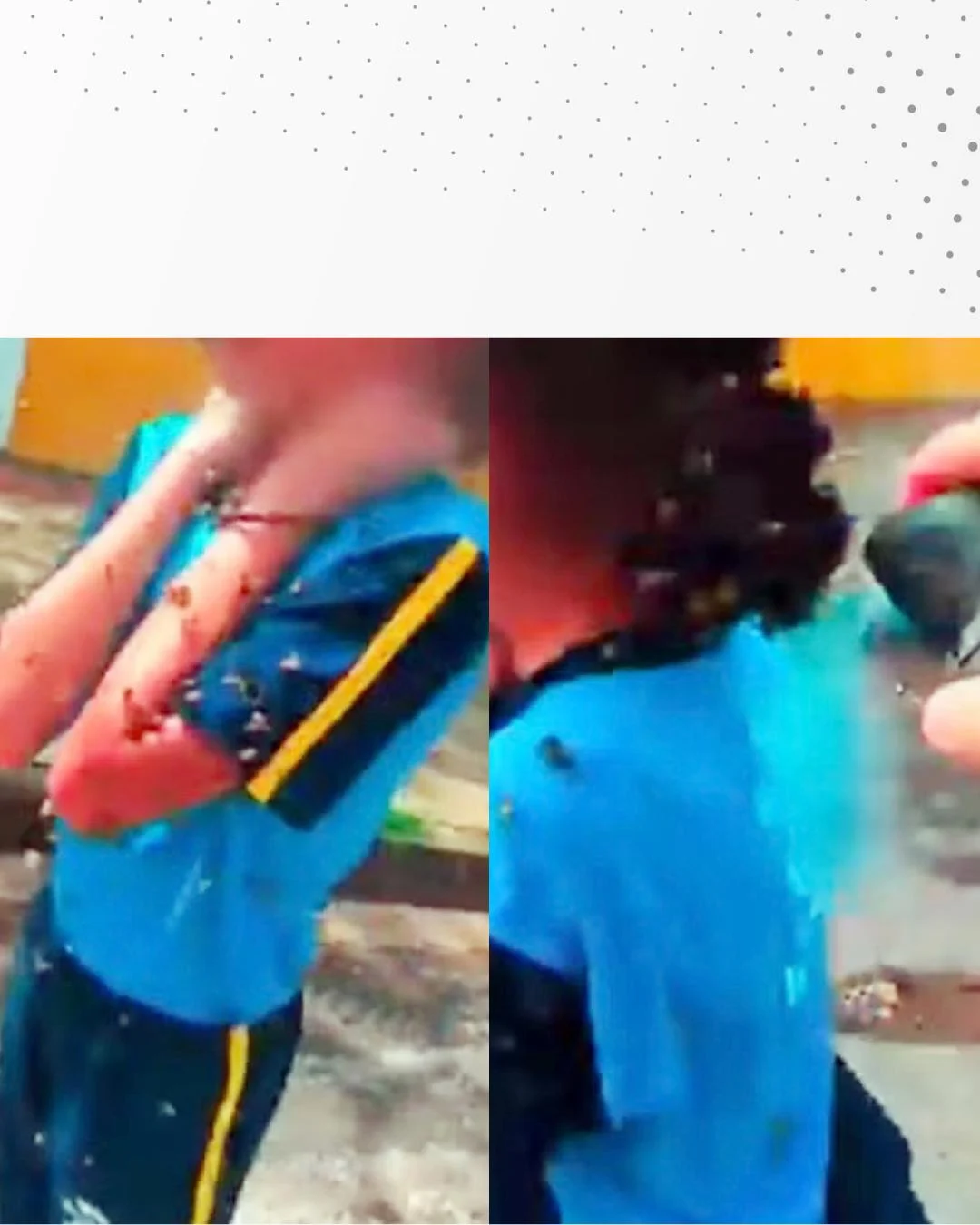 Clínica explica o que a picada de abelha pode causar no corpo e como uma pessoa pode identificar a alergia